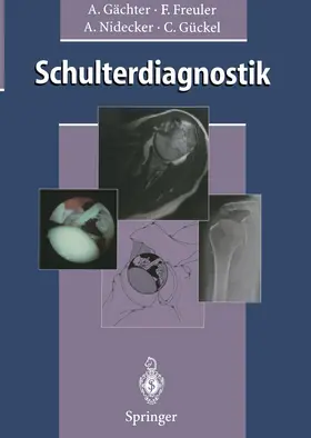 Gächter / Freuler / Nidecker |  Schulterdiagnostik | Buch |  Sack Fachmedien