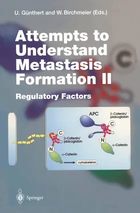 Günthert / Birchmeier |  Attempts to Understand Metastasis Formation II | Buch |  Sack Fachmedien
