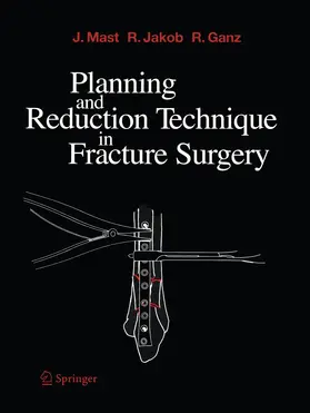 Mast / Jakob / Ganz |  Planning and Reduction Technique in Fracture Surgery | Buch |  Sack Fachmedien