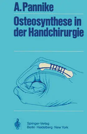 Pannike |  Osteosynthese in der Handchirurgie | eBook | Sack Fachmedien