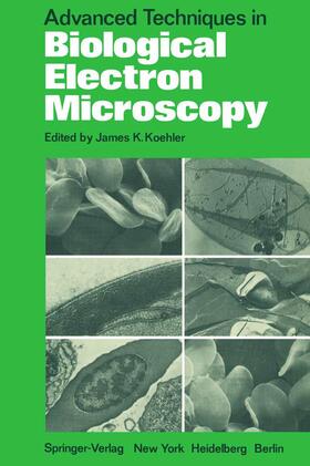 Koehler | Advanced Techniques in Biological Electron Microscopy | Buch | 978-3-642-65494-7 | sack.de