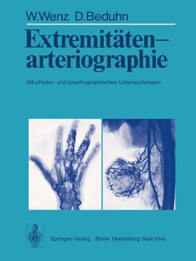 Wenz / Beduhn |  Extremitätenarteriographie | Buch |  Sack Fachmedien