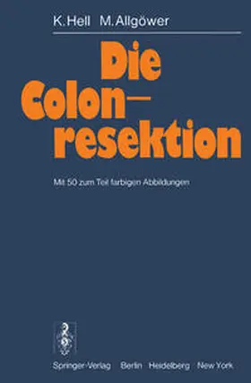 Hell / Allgöwer |  Die Colonresektion | eBook | Sack Fachmedien