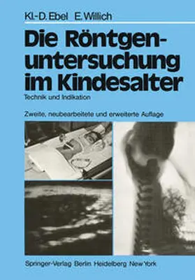 Ebel / Willich |  Die Röntgenuntersuchung im Kindesalter | eBook | Sack Fachmedien