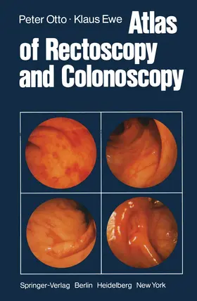 Otto / Ewe |  Atlas of Rectoscopy and Coloscopy | Buch |  Sack Fachmedien