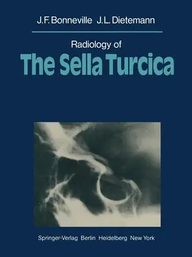 Bonneville / Dietemann |  Radiology of The Sella Turcica | Buch |  Sack Fachmedien
