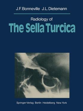 Dietemann / Bonneville | Radiology of The Sella Turcica | Buch | 978-3-642-67788-5 | sack.de