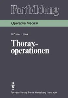 Zeidler / Weik |  Thoraxoperationen | eBook | Sack Fachmedien