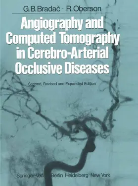 Bradac / Oberson | Angiography and Computed Tomography in Cerebro-Arterial Occlusive Diseases | Buch | 978-3-642-68556-9 | www.sack.de