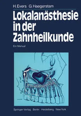 Evers / Hakansson / Haegerstam |  Lokalanästhesie in der Zahnheilkunde | eBook | Sack Fachmedien