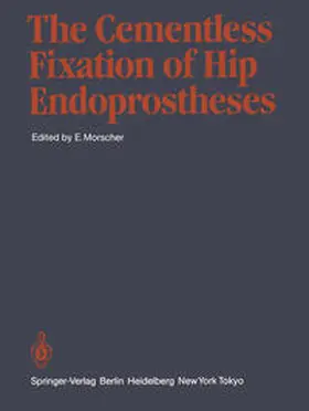 Morscher |  The Cementless Fixation of Hip Endoprostheses | Buch |  Sack Fachmedien