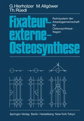 Hierholzer / Allgöwer / Rüedi |  Fixateur-externe-Osteosynthese | Buch |  Sack Fachmedien