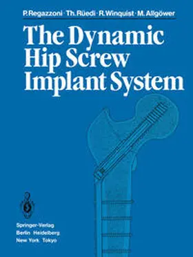 Regazzoni / Rüedi / Winquist |  The Dynamic Hip Screw Implant System | eBook | Sack Fachmedien