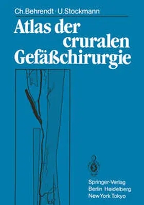Behrendt / Stockmann |  Atlas der cruralen Gefäßchirurgie | eBook | Sack Fachmedien