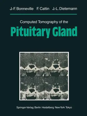 Bonneville / Cattin / Dietemann |  Computed Tomography of the Pituitary Gland | Buch |  Sack Fachmedien