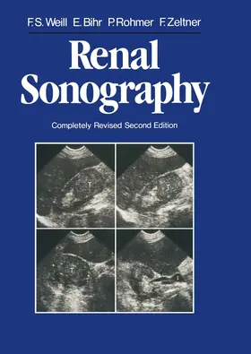Weill / Bihr / Rohmer |  Renal Sonography | Buch |  Sack Fachmedien