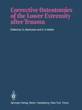 Hierholzer / Müller |  Corrective Osteotomies of the Lower Extremity after Trauma | Buch |  Sack Fachmedien