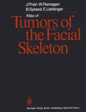 Prein / Remagen / Spiessl |  Atlas of Tumors of the Facial Skeleton | eBook | Sack Fachmedien