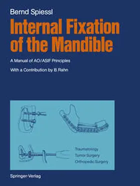 Spiessl |  Internal Fixation of the Mandible | eBook | Sack Fachmedien