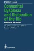 Tönnis |  Congenital Dysplasia and Dislocation of the Hip in Children and Adults | Buch |  Sack Fachmedien