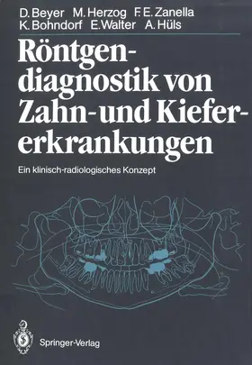 Walter / Beyer / Herzog |  Röntgendiagnostik von Zahn- und Kiefererkrankungen | Buch |  Sack Fachmedien