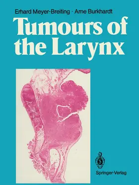 Meyer-Breiting / Burkhardt |  Tumours of the Larynx | Buch |  Sack Fachmedien