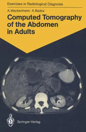 Wackenheim / Badoz |  Computed Tomography of the Abdomen in Adults | eBook | Sack Fachmedien