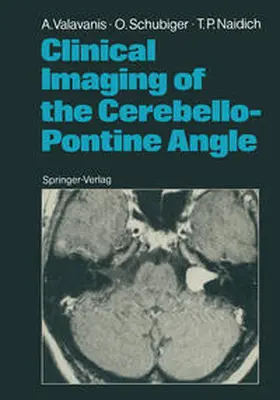 Valavanis / Schubiger / Naidich |  Clinical Imaging of the Cerebello-Pontine Angle | eBook | Sack Fachmedien