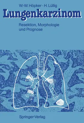 Höpker / Lüllig |  Lungenkarzinom | Buch |  Sack Fachmedien