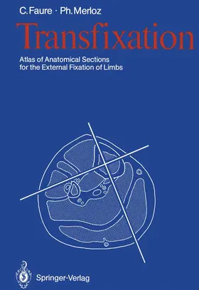 Faure / Merloz |  Transfixation | Buch |  Sack Fachmedien