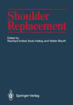 Kölbel / Helbig / Blauth |  Shoulder Replacement | Buch |  Sack Fachmedien