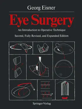 Eisner |  Eye Surgery | Buch |  Sack Fachmedien