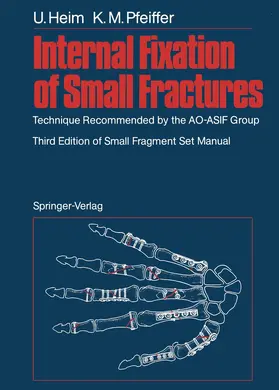 Heim / Pfeiffer |  Internal Fixation of Small Fractures | Buch |  Sack Fachmedien