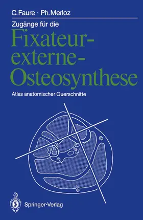 Faure / Merloz |  Zugänge für die Fixateur-externe-Osteosynthese | Buch |  Sack Fachmedien