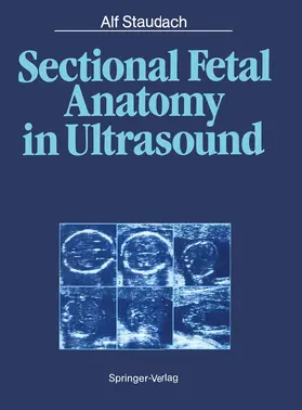 Staudach |  Sectional Fetal Anatomy in Ultrasound | Buch |  Sack Fachmedien