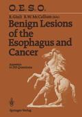 McCallum / Giuli |  Benign Lesions of the Esophagus and Cancer | Buch |  Sack Fachmedien