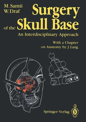 Samii / Draf |  Surgery of the Skull Base | Buch |  Sack Fachmedien