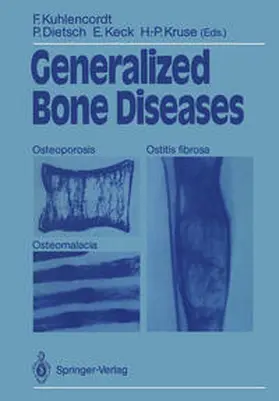 Kuhlencordt / Dietsch / Keck |  Generalized Bone Diseases | eBook | Sack Fachmedien