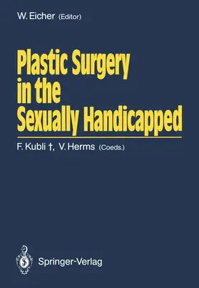 Eicher |  Plastic Surgery in the Sexually Handicapped | Buch |  Sack Fachmedien