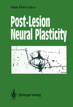 Flohr |  Post-Lesion Neural Plasticity | eBook | Sack Fachmedien