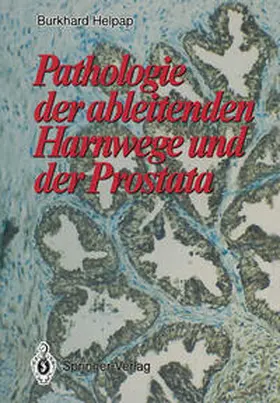 Helpap |  Pathologie der ableitenden Harnwege und der Prostata | eBook | Sack Fachmedien