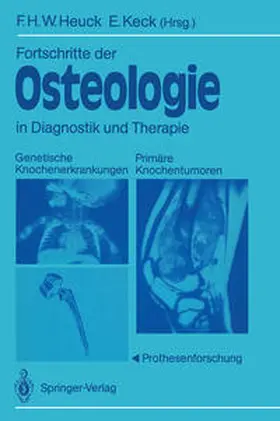 Heuck / Keck |  Fortschritte der Osteologie in Diagnostik und Therapie | eBook | Sack Fachmedien