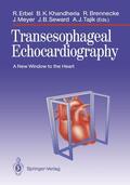 Erbel / Khandheria / Tajik |  Transesophageal Echocardiography | Buch |  Sack Fachmedien