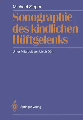 Zieger |  Sonographie des kindlichen Hüftgelenks | Buch |  Sack Fachmedien