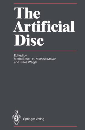 Brock / Weigel / Mayer |  The Artificial Disc | Buch |  Sack Fachmedien