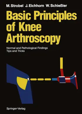 Strobel / Schießler / Eichhorn |  Basic Principles of Knee Arthroscopy | Buch |  Sack Fachmedien