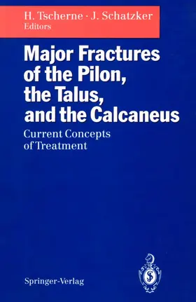 Tscherne / Schatzker |  Major Fractures of the Pilon, the Talus, and the Calcaneus | Buch |  Sack Fachmedien