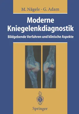 Nägele / Adam / Otto |  Moderne Kniegelenkdiagnostik | Buch |  Sack Fachmedien