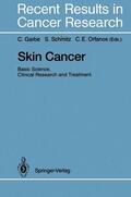 Garbe / Orfanos / Schmitz |  Skin Cancer: Basic Science, Clinical Research and Treatment | Buch |  Sack Fachmedien