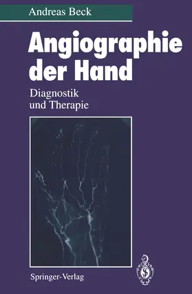 Beck |  Angiographie der Hand | Buch |  Sack Fachmedien